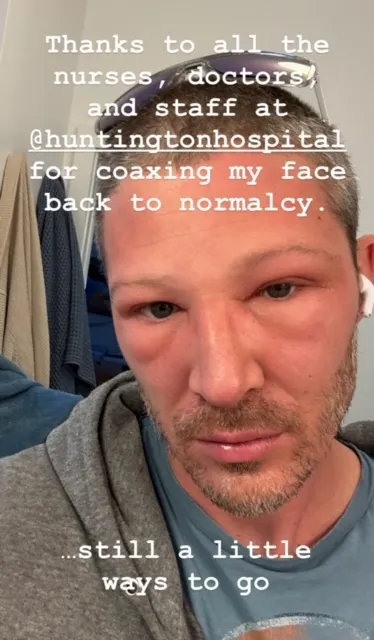 Zach Gilford health scare