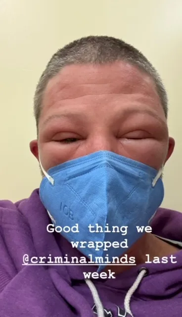 Zach Gilford health scare 2