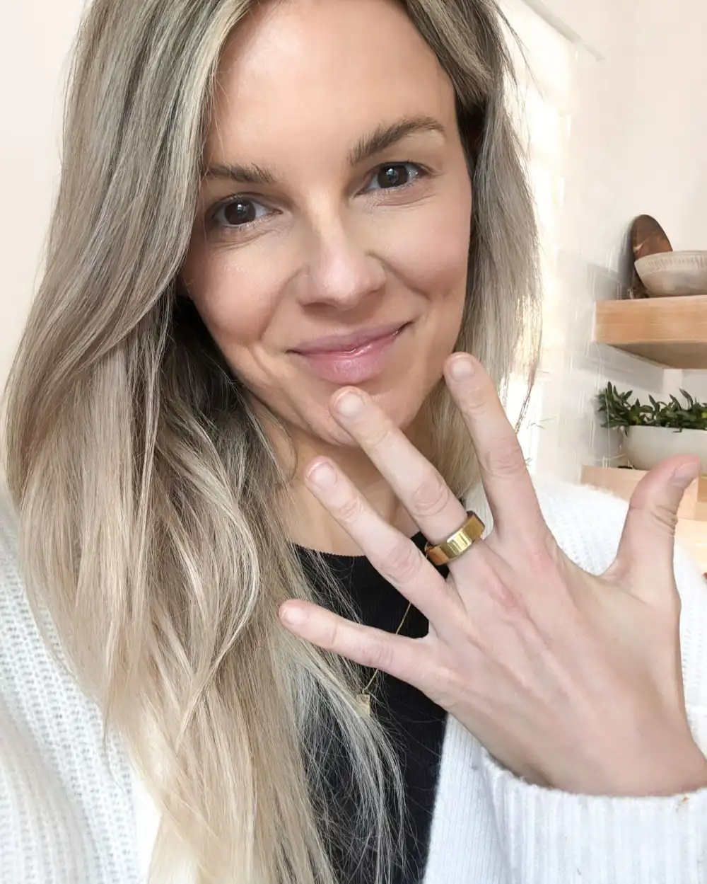 Ali Fedotowsky Shares Update on Special Forces Injury After Show Exit