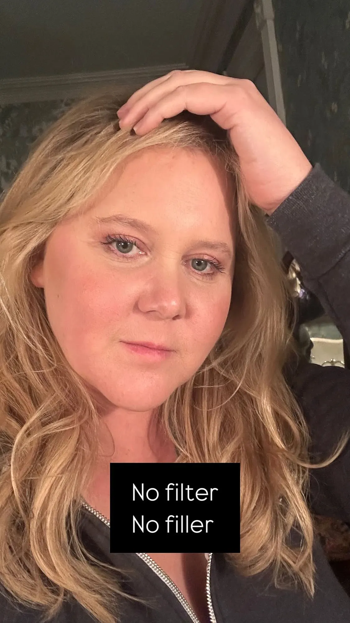 Amy Schumer Shares Fresh-Face Selfie With ‘No Filter’ and ‘No Filler’
