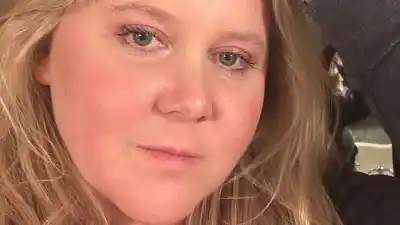 Amy Schumer Shares Fresh-Face Selfie With ‘No Filter’ and ‘No Filler’