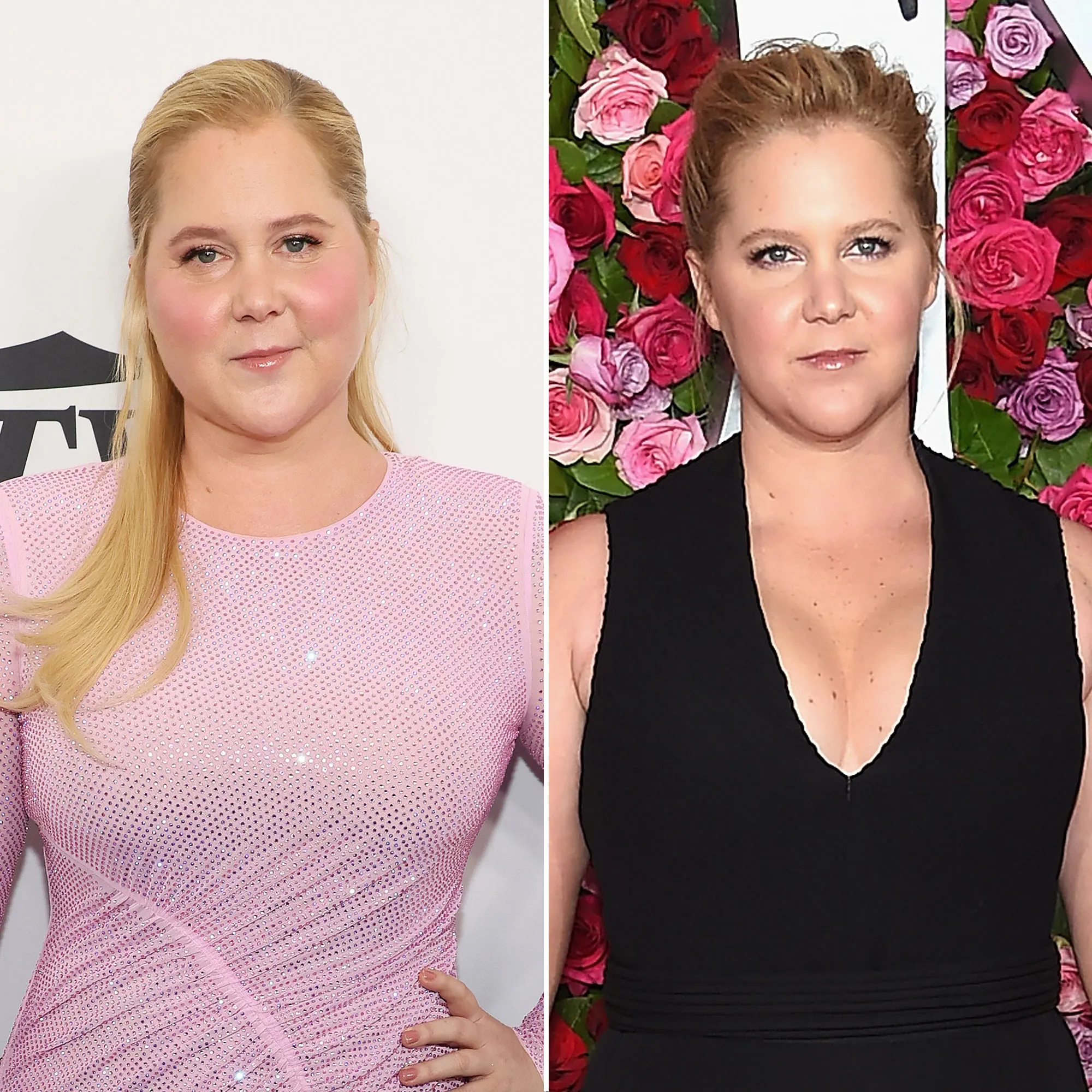 Amy Shumer Reveals How She Found out She Has Cushing Syndrome