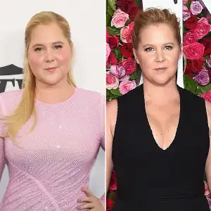 Amy Shumer Reveals How She Found out She Has Cushing Syndrome