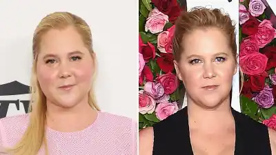 Amy Shumer Reveals How She Found out She Has Cushing Syndrome