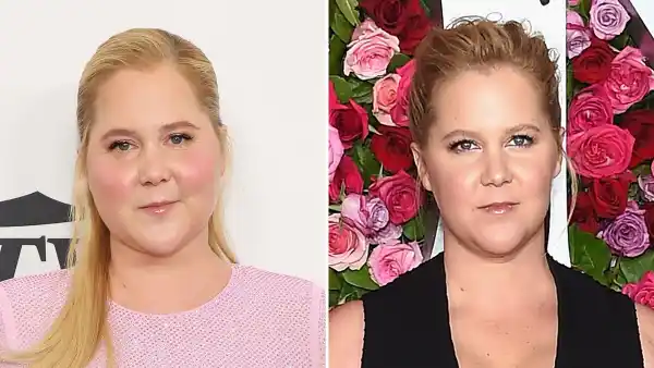 Amy Shumer Reveals How She Found out She Has Cushing Syndrome