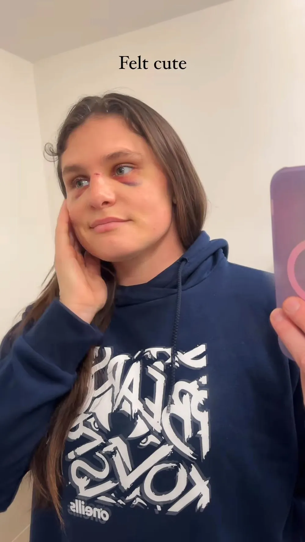 Ilona Maher Shows Off Steamy Bikini Pic After Breaking Her Nose 908