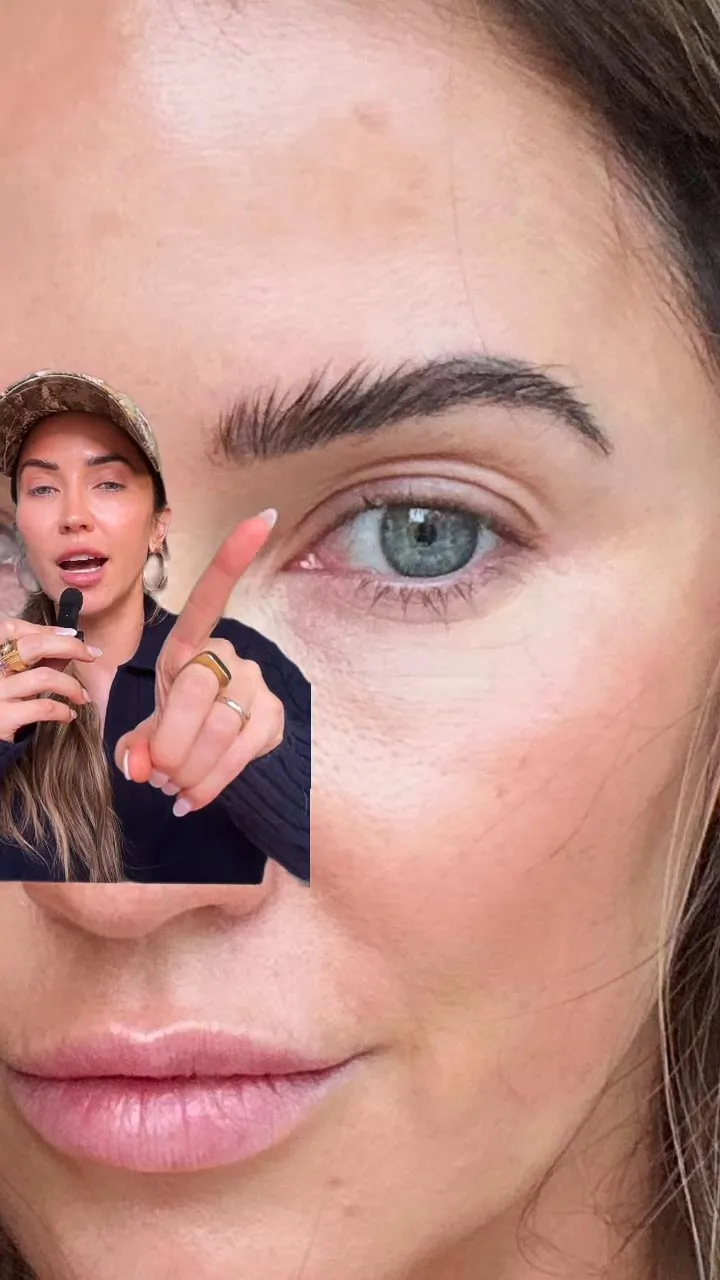 Kaitlyn Bristowe s Dog Clawed Her Stitches After 1st Ever Plastic Surgery 007