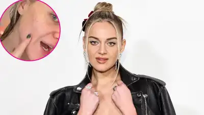 PROMO Kelsea Ballerini Gets a Stress Breakout Before Hitting Stage on Tour
