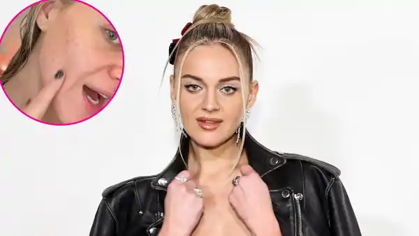 PROMO Kelsea Ballerini Gets a Stress Breakout Before Hitting Stage on Tour