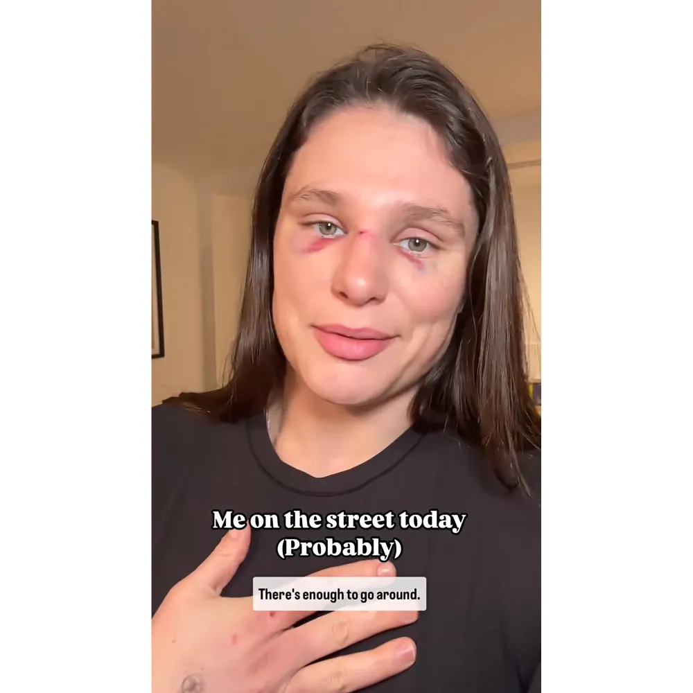 Olympian Ilona Maher Is Not OK After Breaking Her Nose in Rugby Match