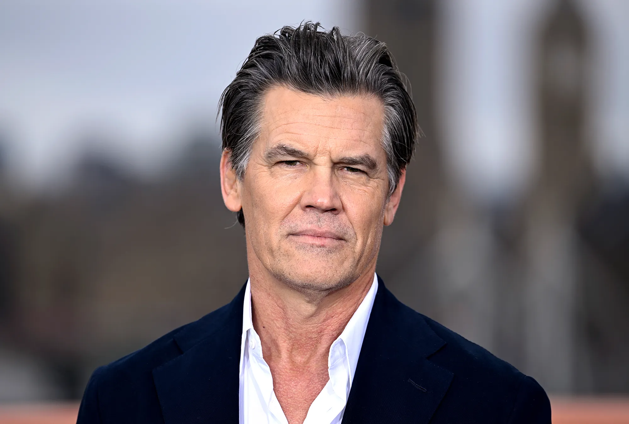 Josh Brolin Opens Up About Bells Palsy