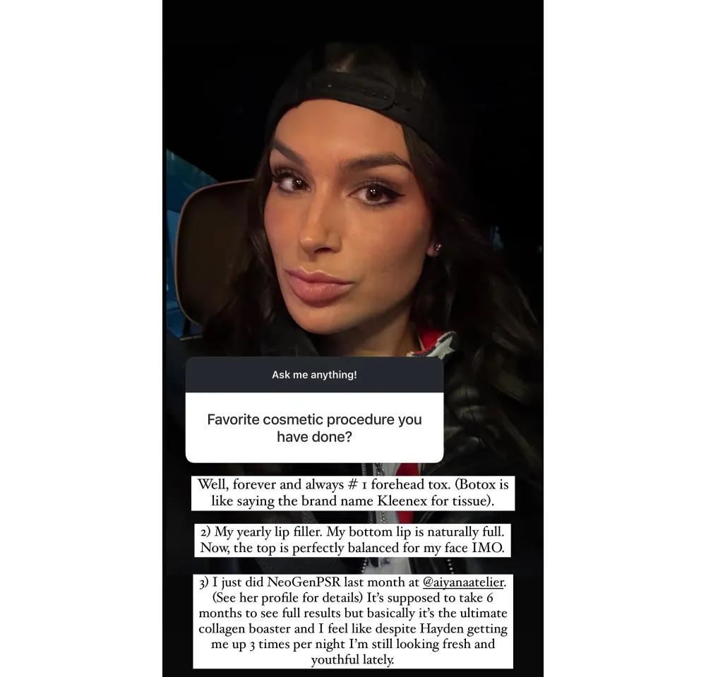 Ashley Iaconetti Details What Will 'Forever and Always' Be Her Top Plastic Surgery Procedures