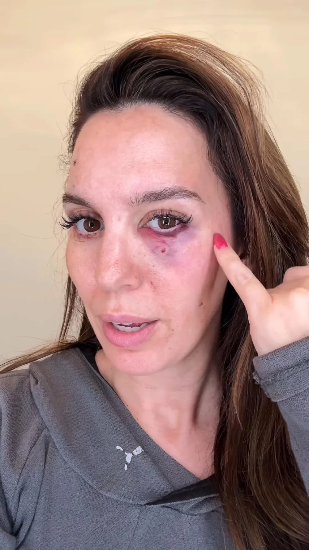 Christy Carlson Romano Claims She Was Shot in the Eye During Husband s Birthday Party 052