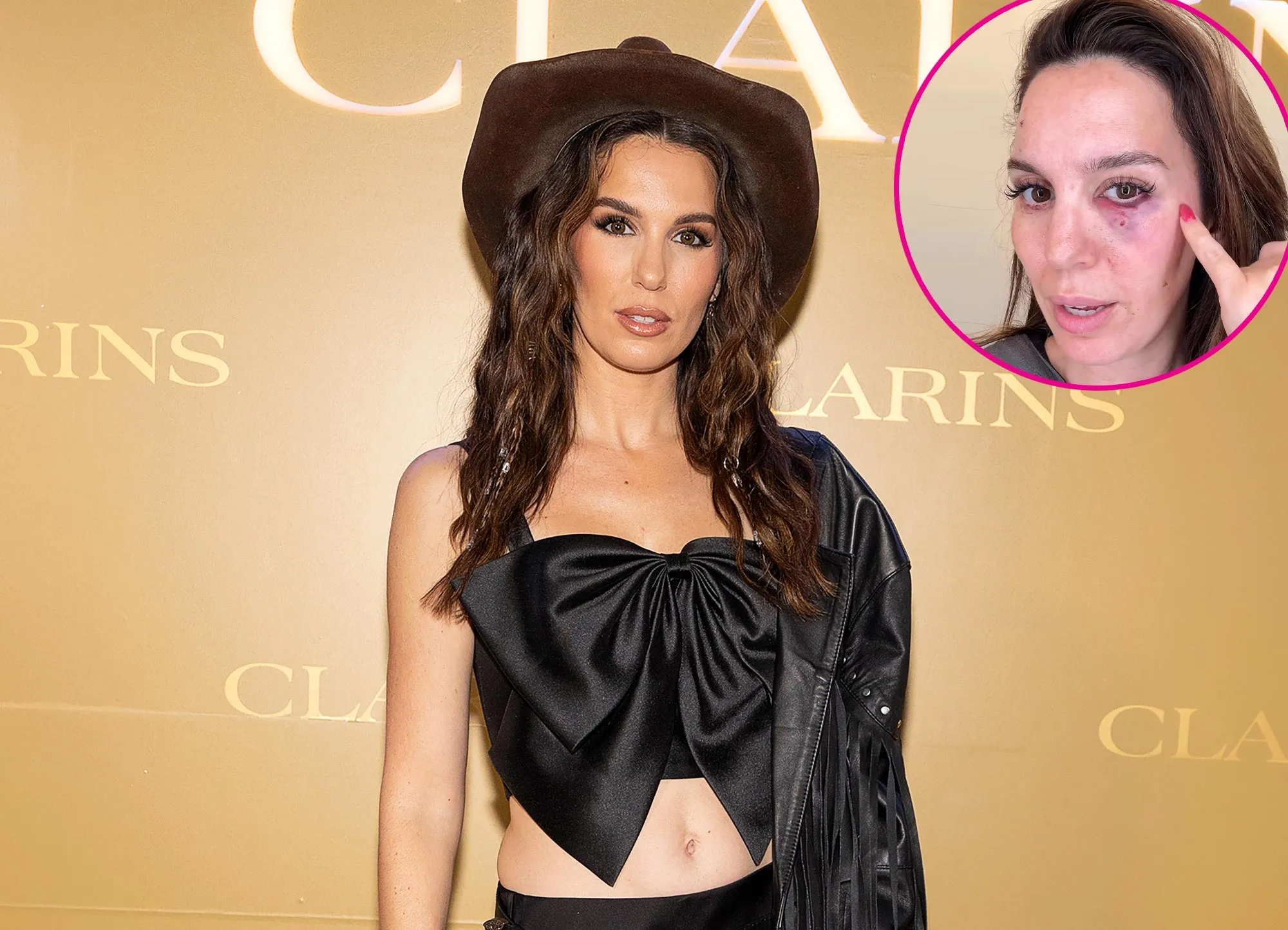 Christy Carlson Romano Claims She Was Shot in the Eye During Husband s Birthday Party 052