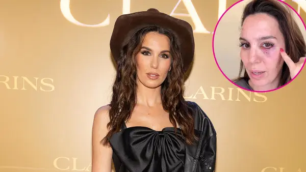 Christy Carlson Romano Claims She Was Shot in the Eye During Husband s Birthday Party 052