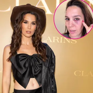 Christy Carlson Romano Claims She Was Shot in the Eye During Husband s Birthday Party 052