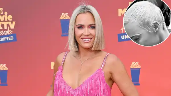 Promo Teddi Mellencamp Has Staples Removed After Brain Tumor Surgery