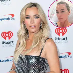 Teddi Mellencamp Gets Hair Buzzed Off as She Undergoes Brain Surgery 240
