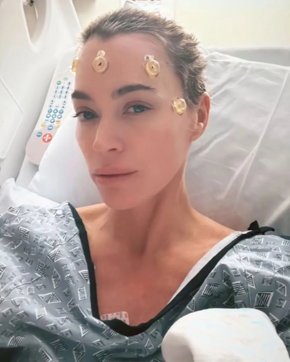 Teddi Mellencamp Has Staples Removed After Brain Tumor Surgery 2