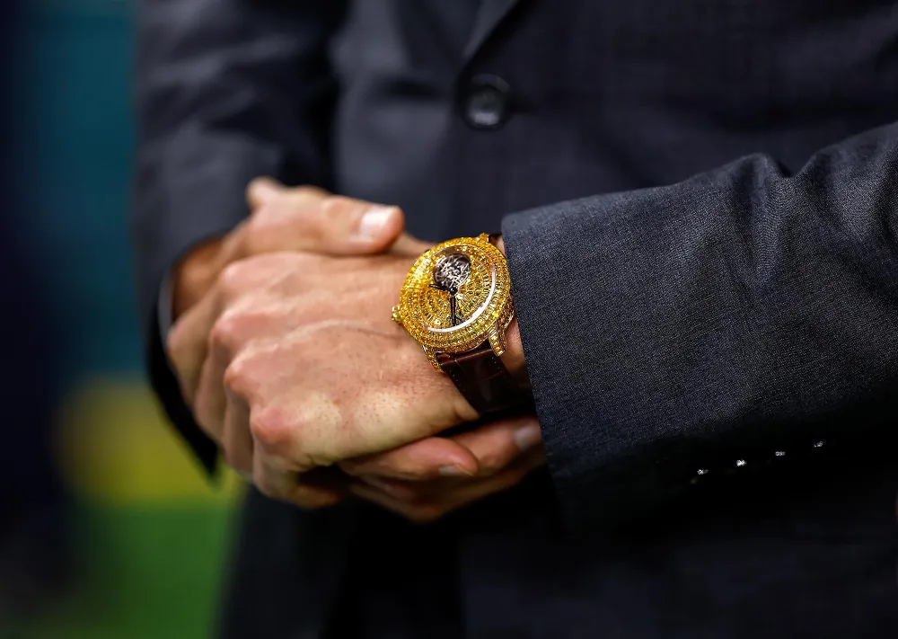 Tom Bradys Super Bowl Watch Cost 730K