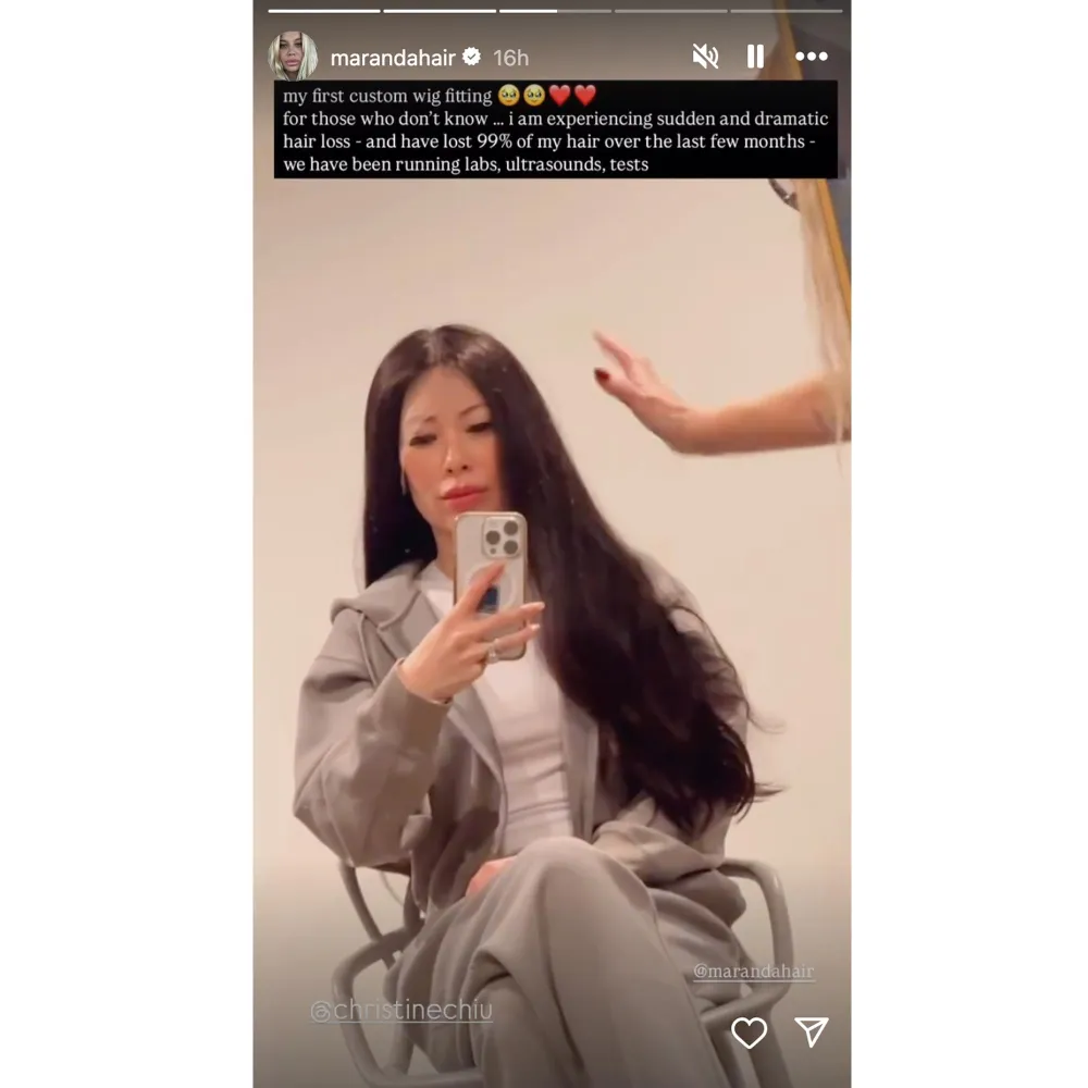 Bling Empires Christine Chiu Last Lost 99 Percent of Her Hair in Past Few Months