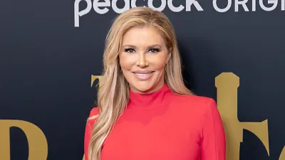 Brandi Glanville Facial Disfigurement Is Starting to Affect Her Teeth