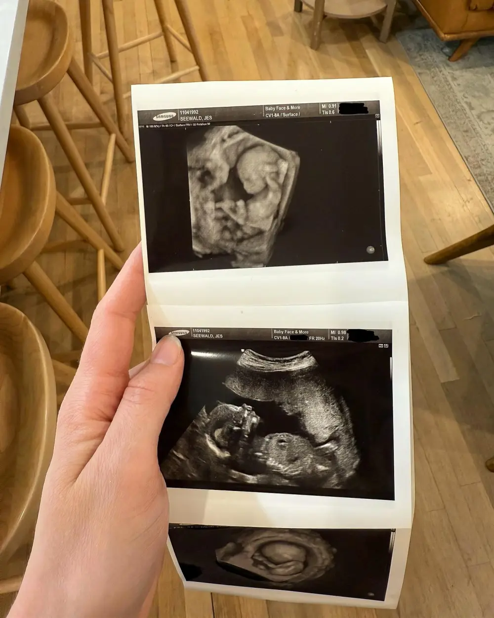 Jessa Duggar Is Pregnant Expecting Baby No 6 With Ben Seewald 997