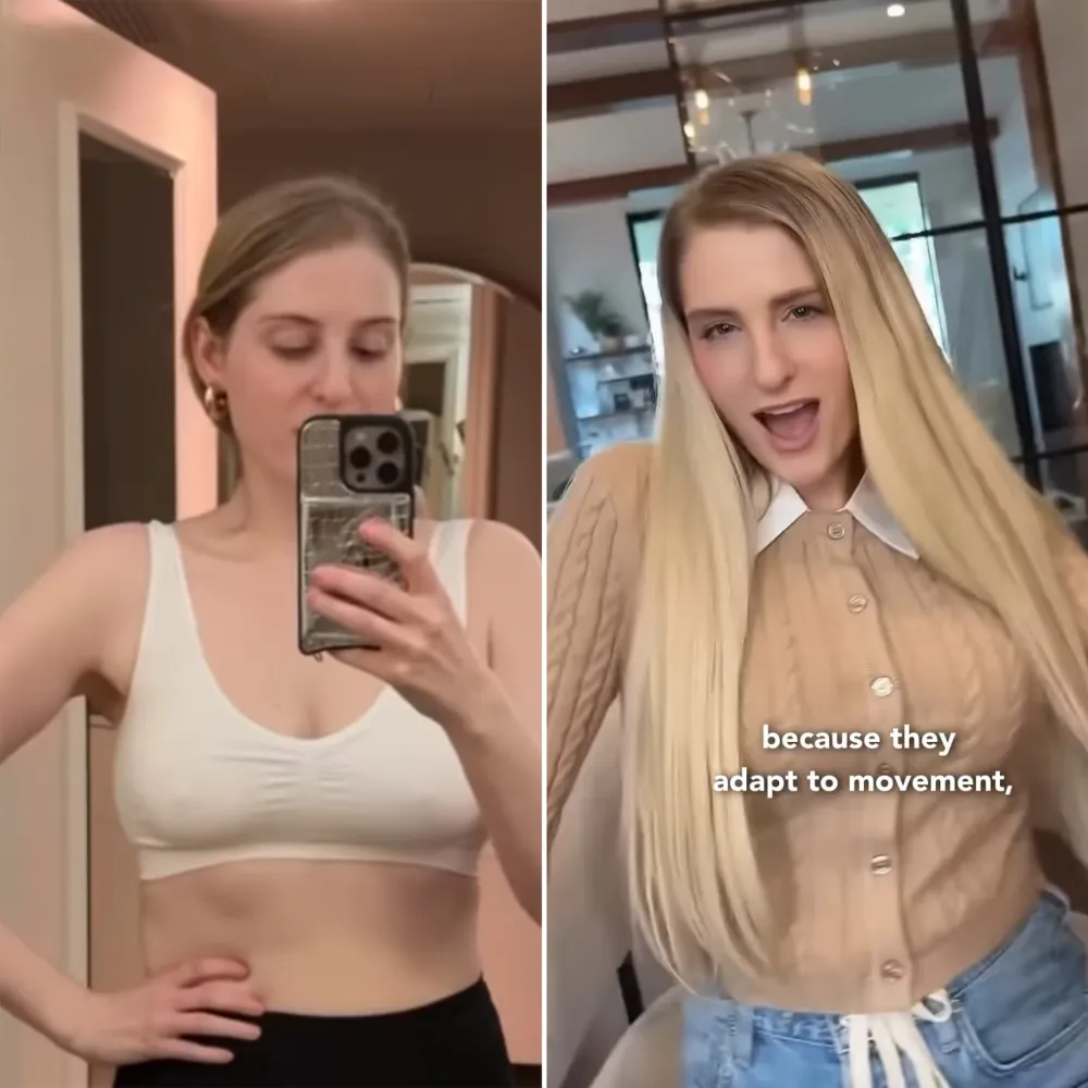 Meghan Trainor Shares Before and After of Getting a Boob Job