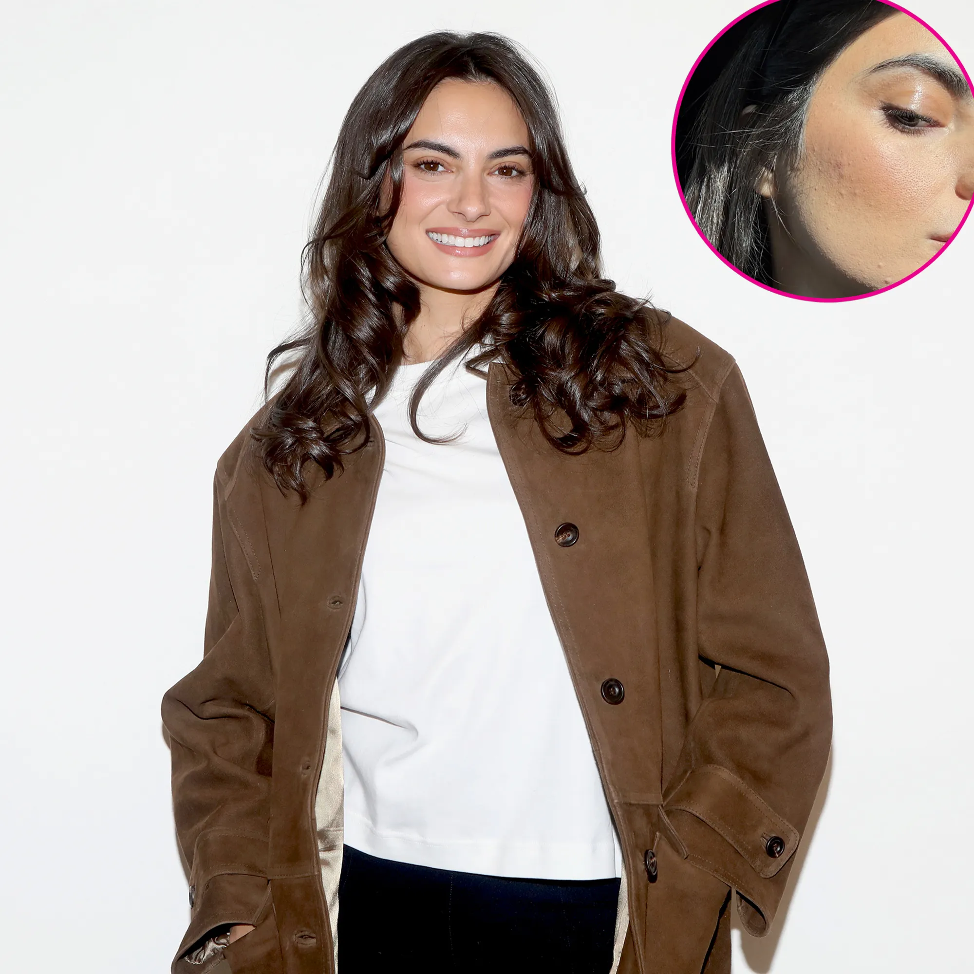 Paige DeSorbo Gives Realistic Look at Her Acne