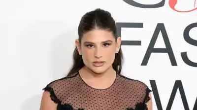 Remi Bader Lost So Much Hair While Recovering From Her Weight Loss Surgery