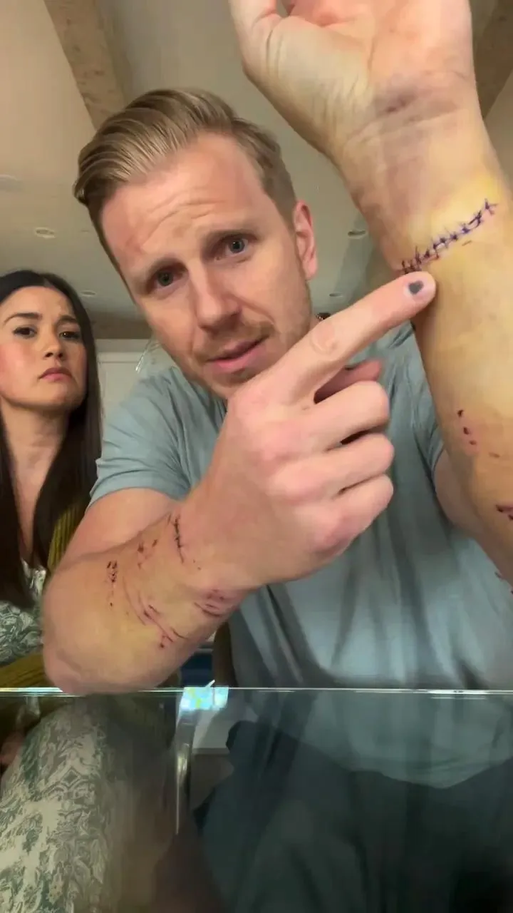 Sean Lowe Shares Update After Being Attacked by His Dog