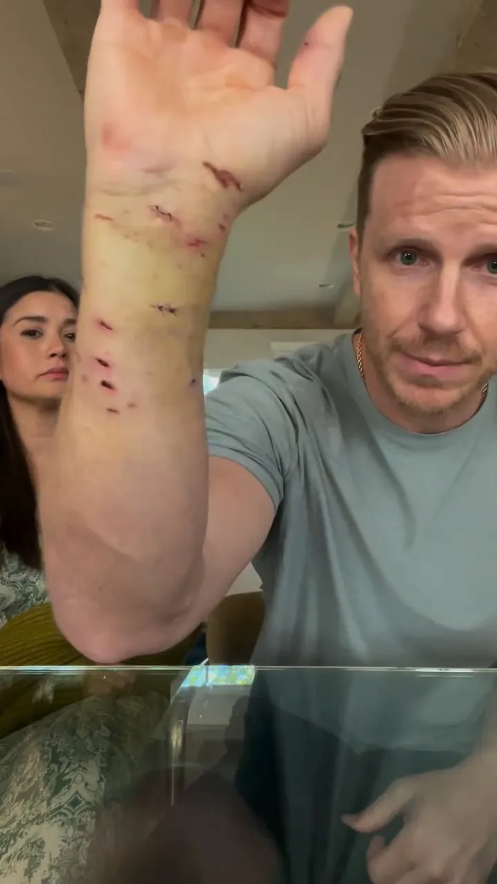 Sean Lowe Shows Off Gnarly Injuries After Getting Attacked by Family Dog Twice in 12 Hours 367