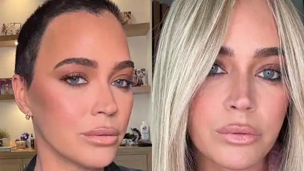 Teddi Mellencamp Doesnt Always Feel Like Wearing a Wig Amid Cancer Diagnosis