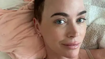 Teddi Mellencamp Says She's 'Ready for Radiation' After Having 4 Tumors Removed During Brain Surgery