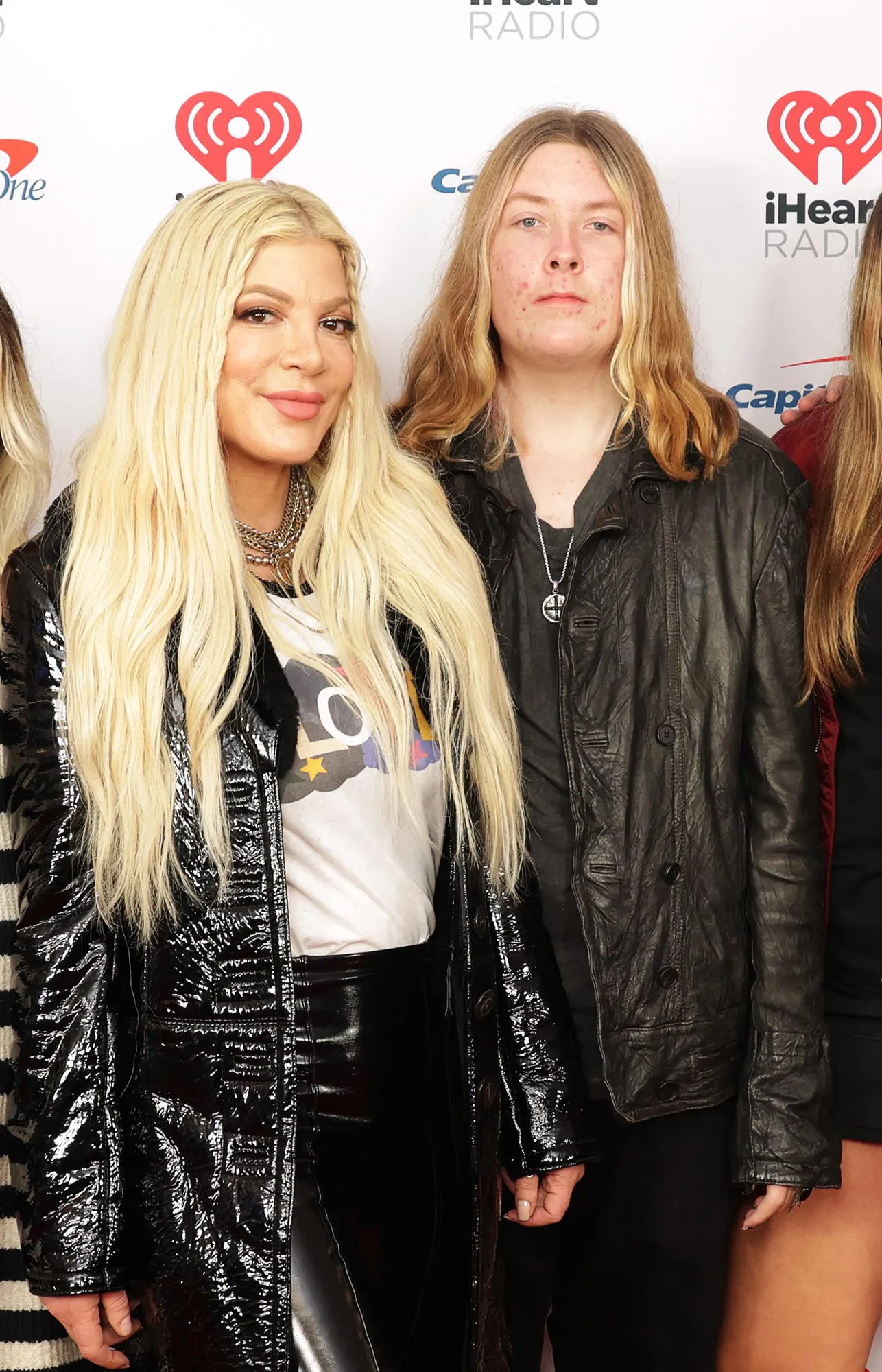 Tori Spelling Reveals Why Son Liam Had Foot Surgery 303