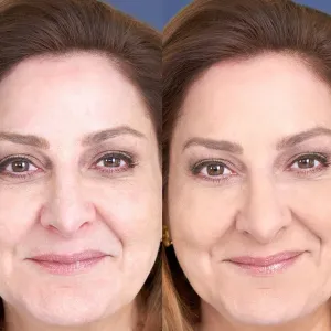 laura-geller-color-correcting-powder-foundation