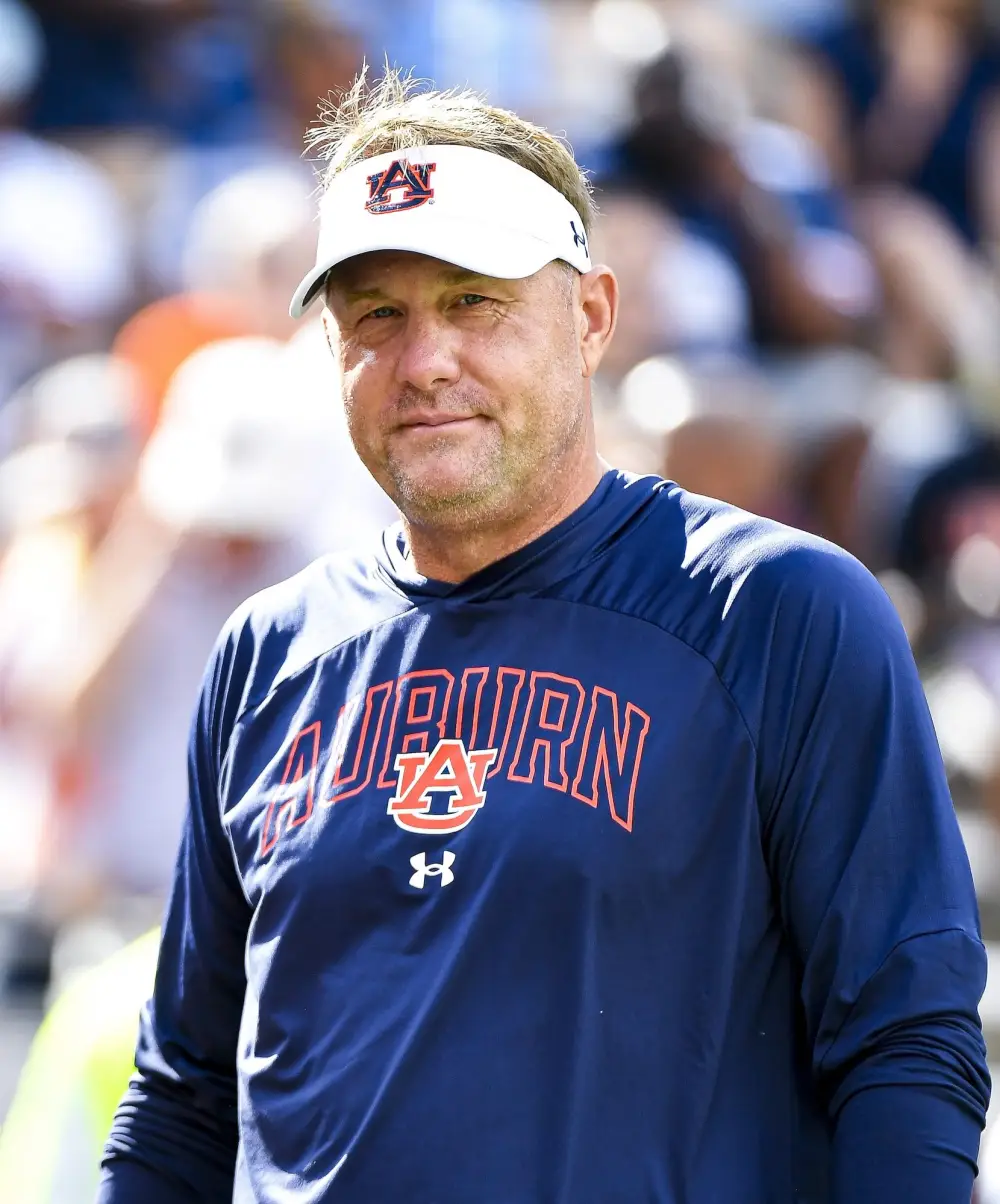 Auburn Football Head Coach Hugh Freeze 55 at Peace After Being Diagnosed With Prostate Cancer