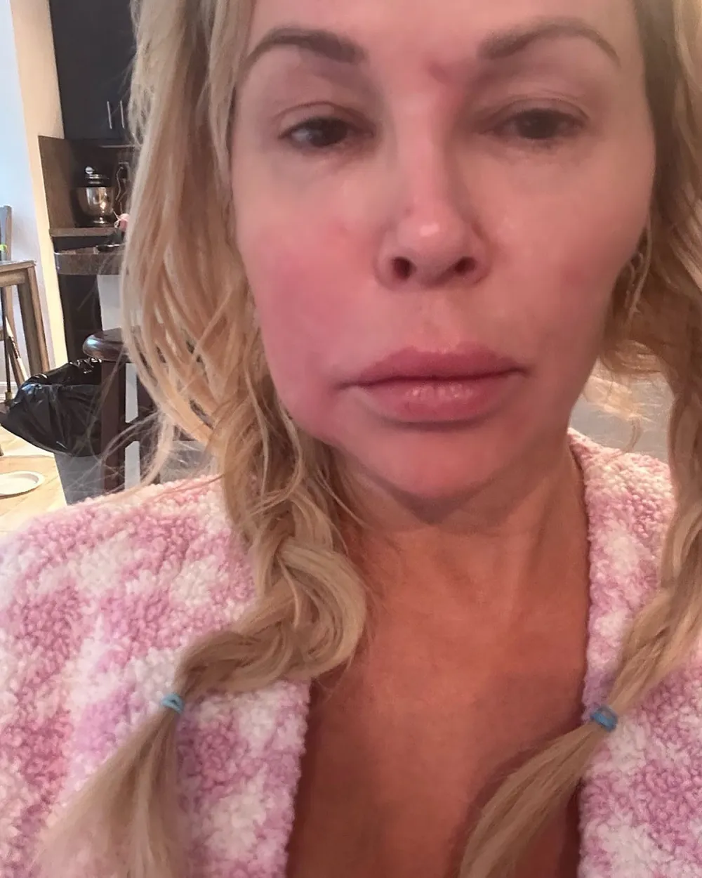 Brandi Glanville Details How Her 2 Sons Have Handled Her Health Issues 2