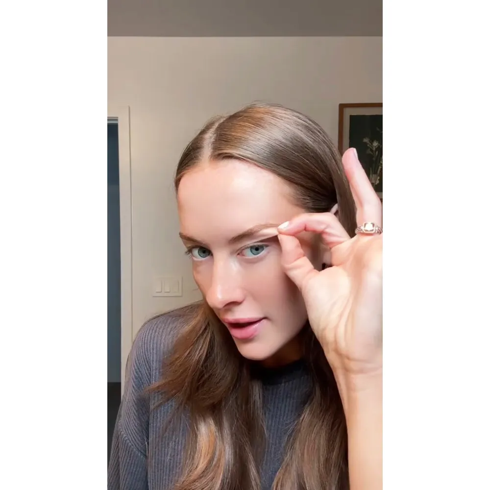 Brooke Schofield Opens Up About Getting an Upper Eyelid Surgery