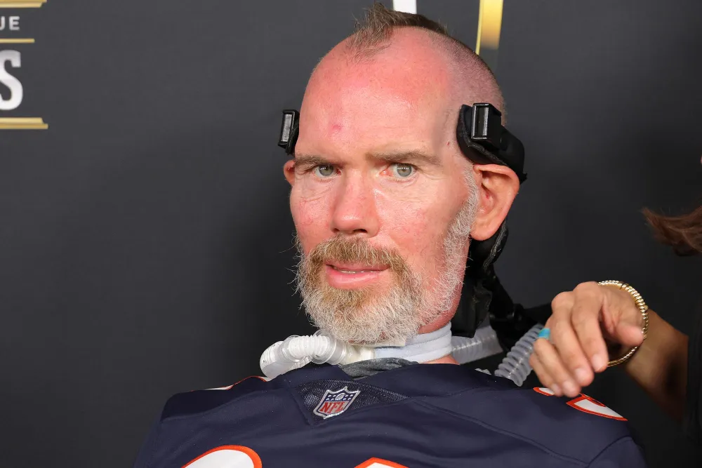 Celebs Whove Battled ALS