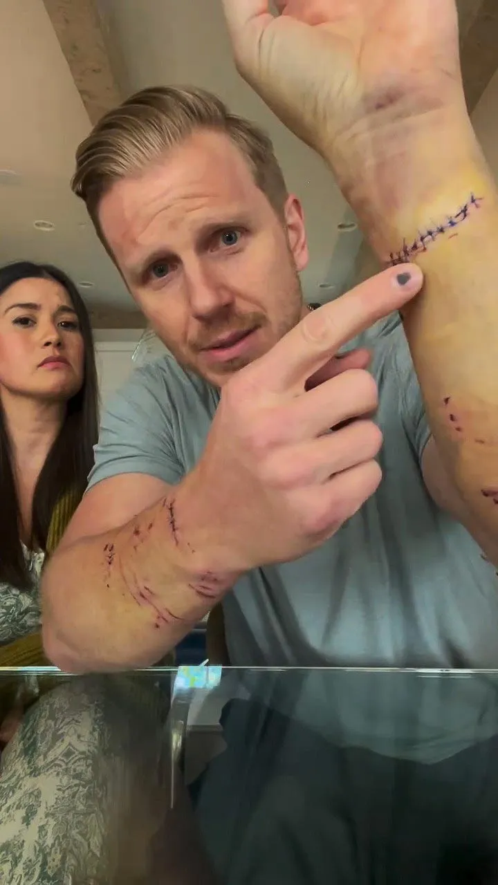 Everything Bachelor Nation s Sean Lowe Has Said About His Dog Attack Pretty Darn Traumatic 859