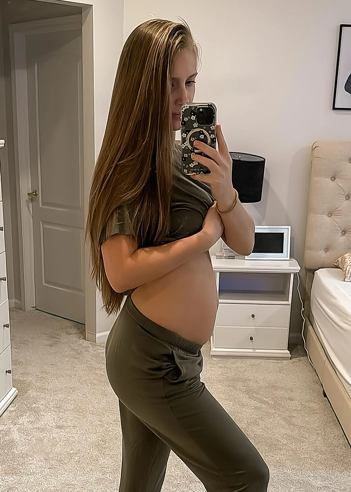 Pregnant Jenna Compono Says Unborn Baby Has a Choroid Plexus Cyst