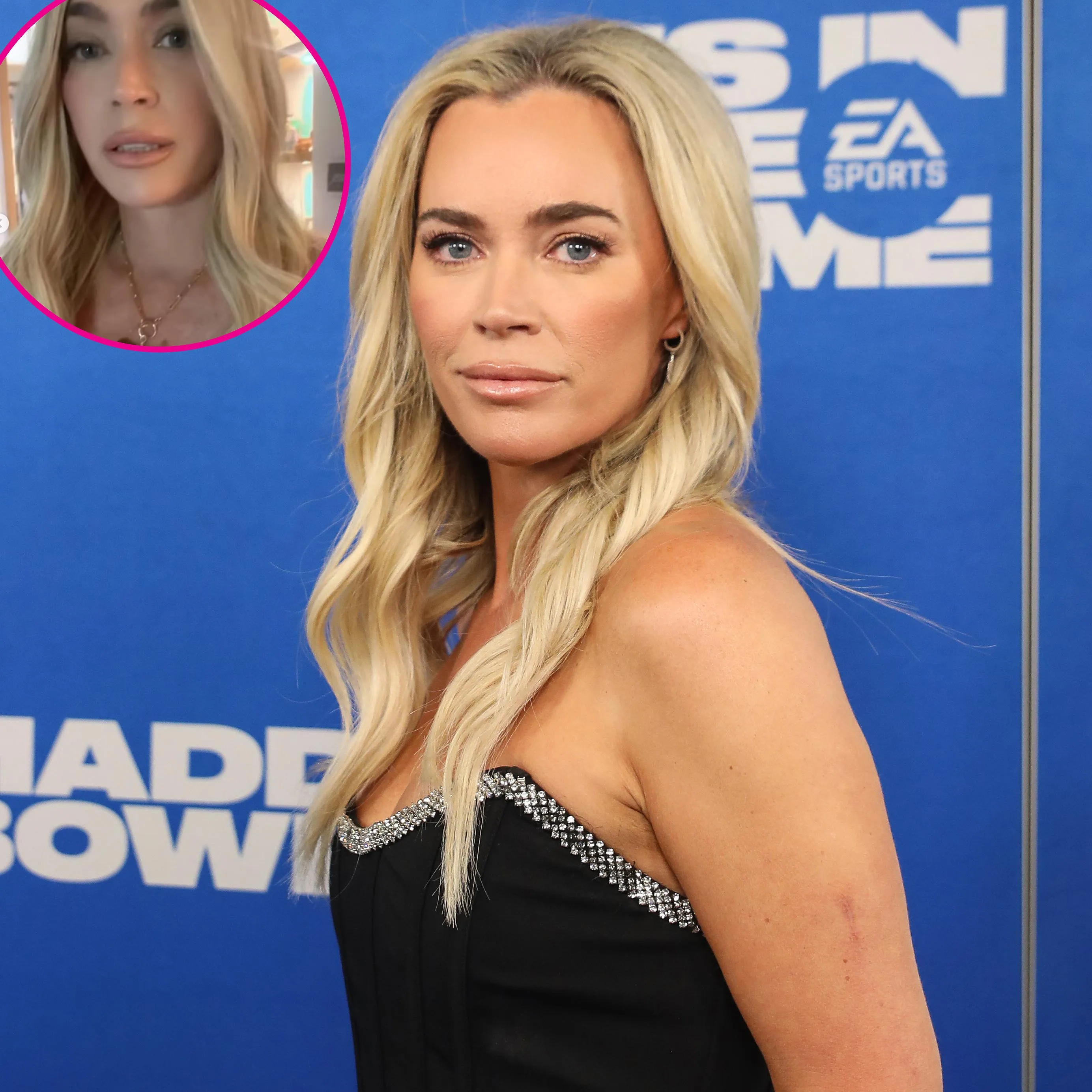 Teddi Mellencamp Debuts Blonde Wig Amid Cancer Treatment