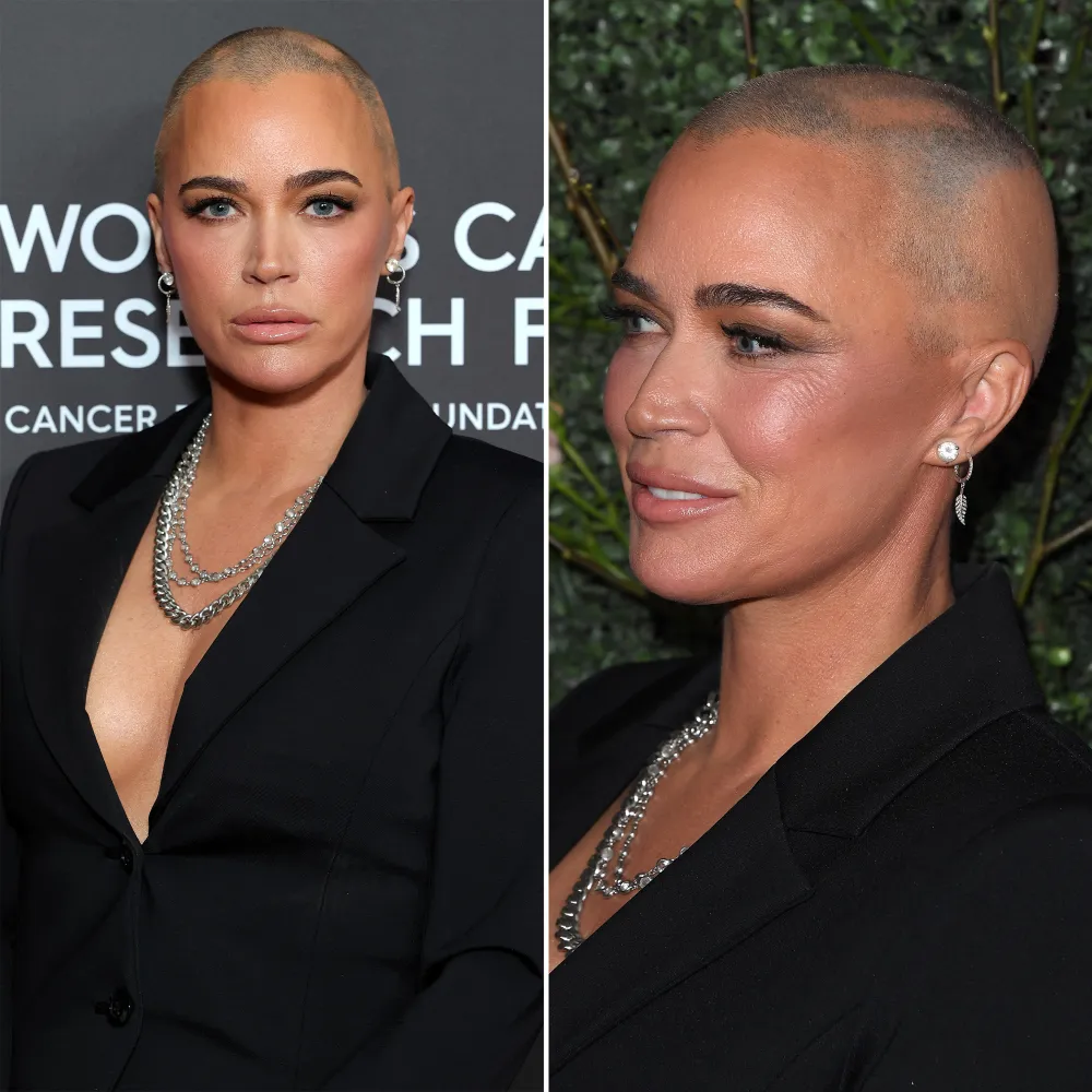 Teddi Mellencamp Proudly Embraces Her Brain Surgery Scars on Red Carpet