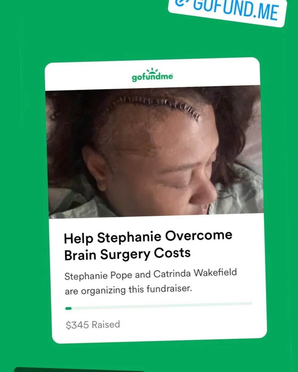 Todric McGee Mother Had Brain Aneurysm 1 Year Before His Death 1