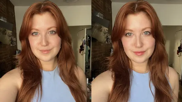 TheOutsetLipTreatmentBeforeAfter