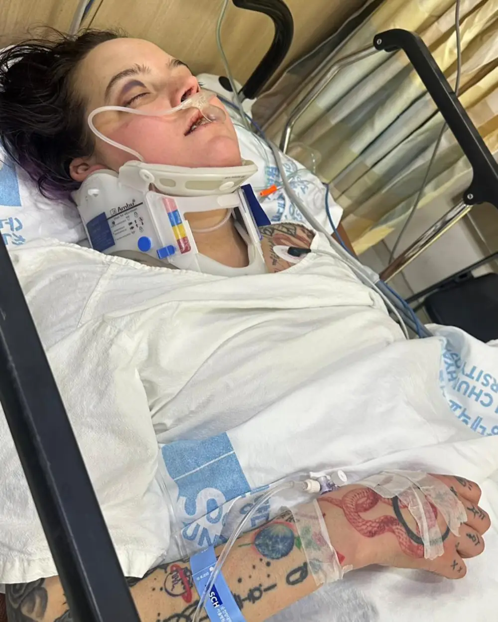 Influencer Ashley Surcombe on Ventilator in ICU After Contracting Pneumonia Amid Hospitalization