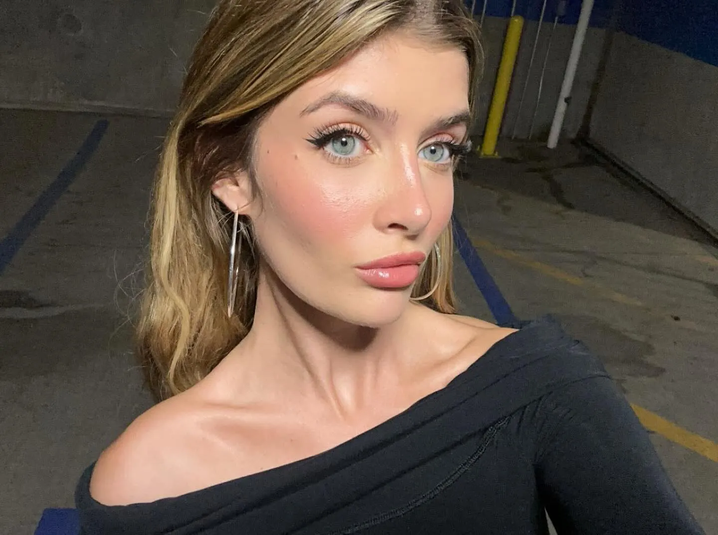 Sami Sheen Offers More Insight Into Plastic Surgery After Viral Video