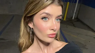 Sami Sheen Offers More Insight Into Plastic Surgery After Viral Video