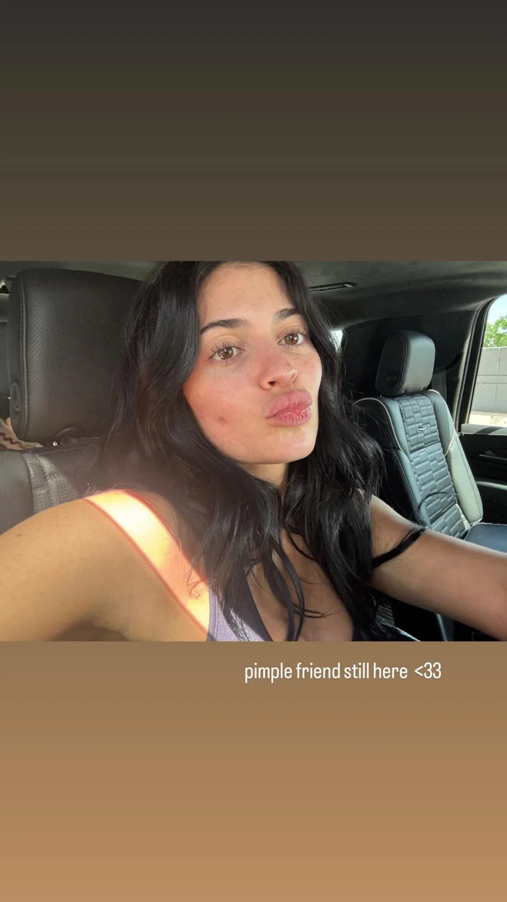Kylie Jenner Goes Au Naturel in Pimple Selfie
